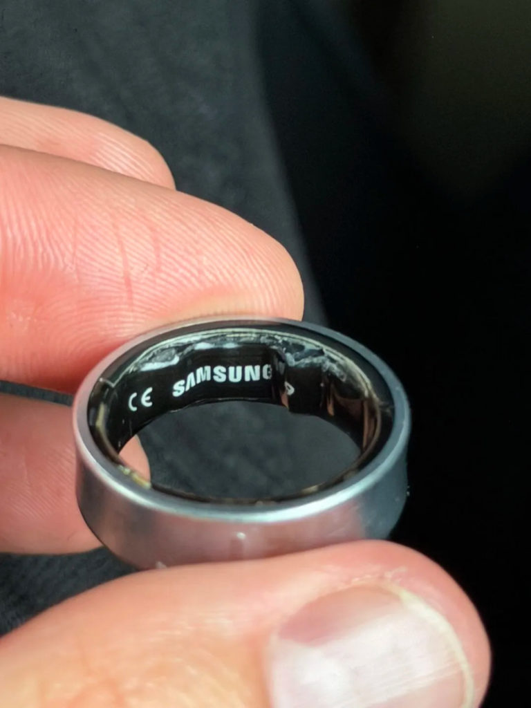 Акумулятор Samsung Galaxy Ring передавив палець користувача та призвів до госпіталізації