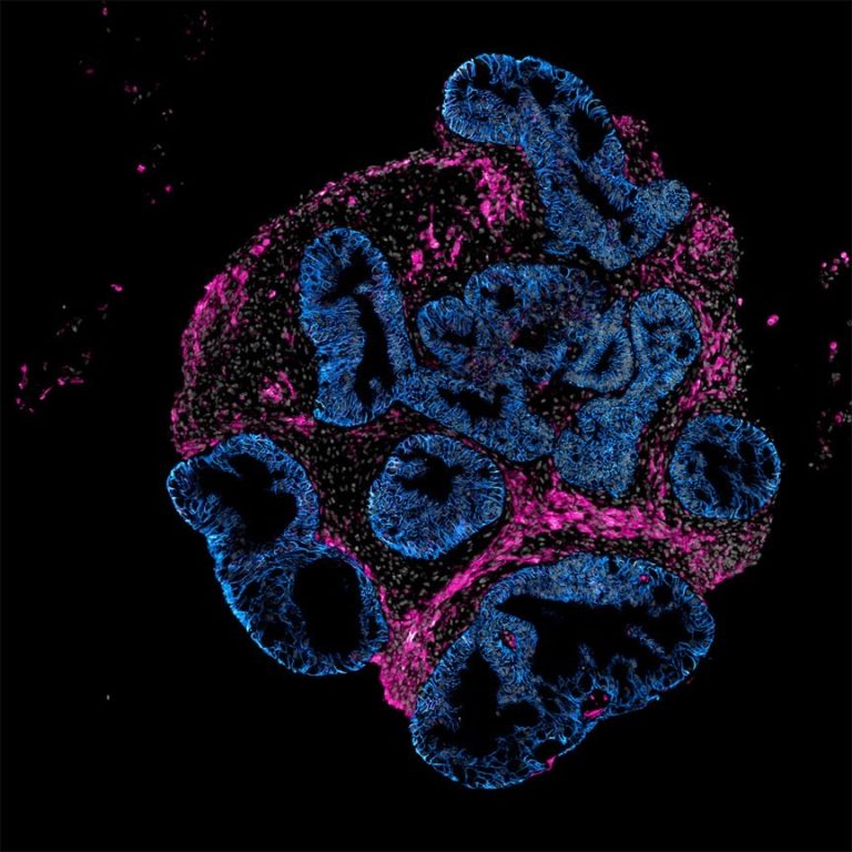 Стартап Intero Biosystems надсилає поштою живі людські кишківники розміром в один міліметр для тестування ліків